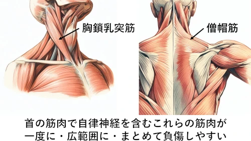 むちうちで痛める筋肉