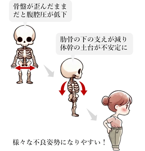 産後の骨盤の歪みの問題