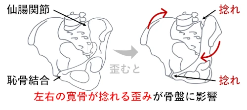 産後の骨盤が痛みやすい理由