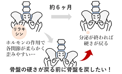産後の骨盤の歪みの問題