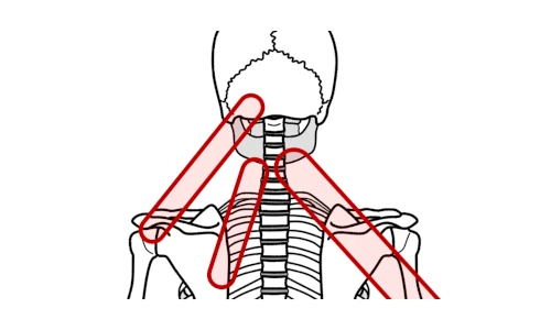 首から肩や腕にも感じる首の痛み