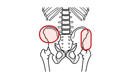 骨盤の左右で上や横で感じる骨盤の痛み