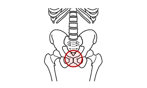 骨盤の前で感じる骨盤の痛み